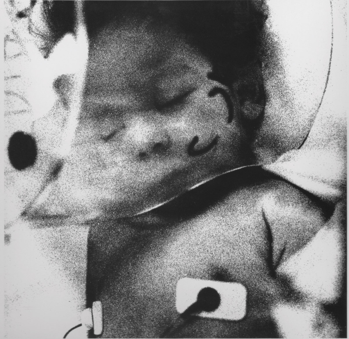 Brian Weil, Flavia Before Her Death at Two, Brooklyn, NewYork, 1985